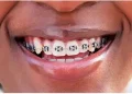 DR