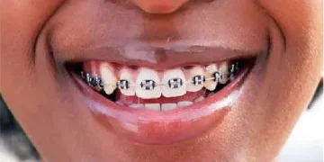 DR